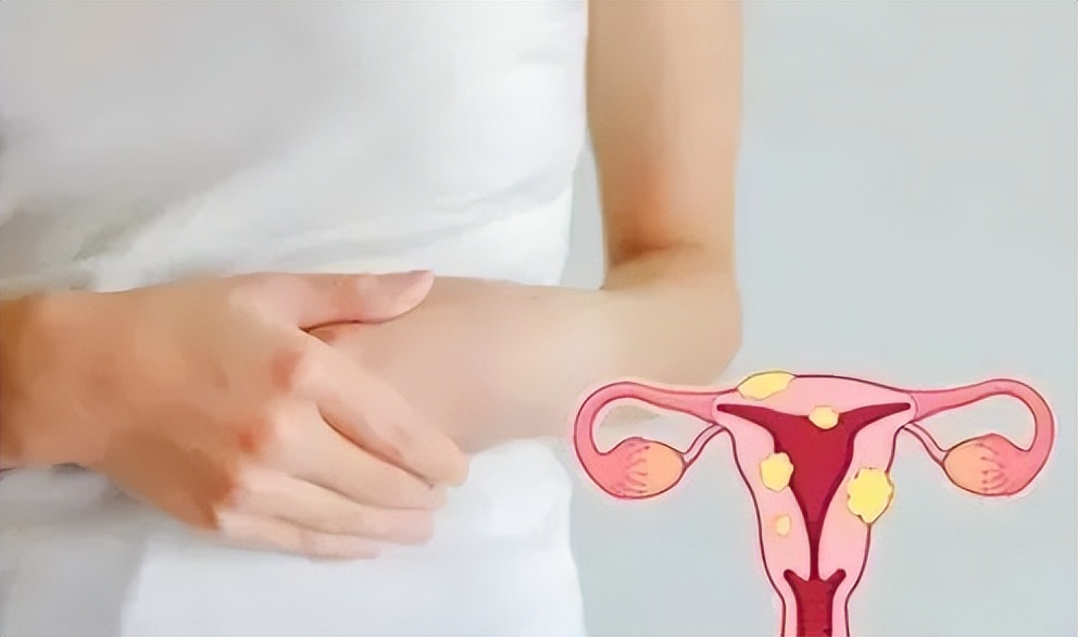 hpv阳性18宫颈癌症状,hpv感染属于重大疾病吗