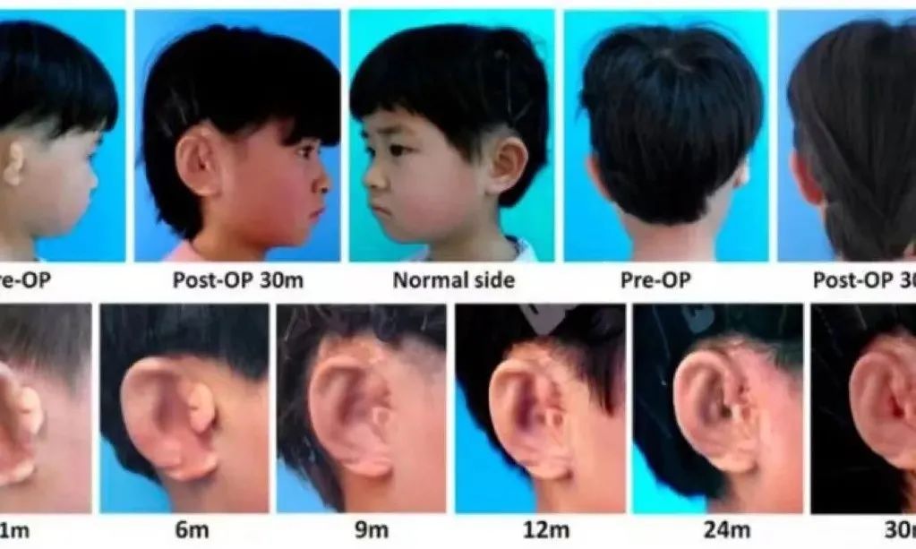 干细胞在3d打印中的应用,干细胞3d打印教程