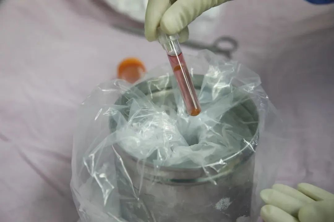 中山六院精子质量检查,中山精子质量检查