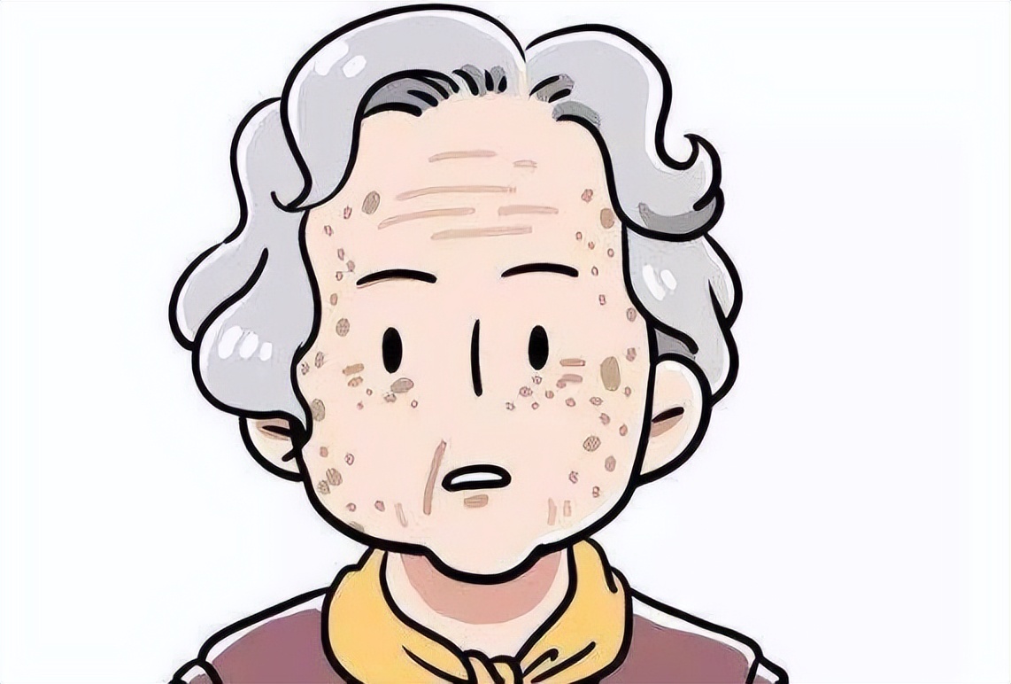 快速消除老年斑的小妙招红霉素,祛老年斑的最佳方法红霉素软膏