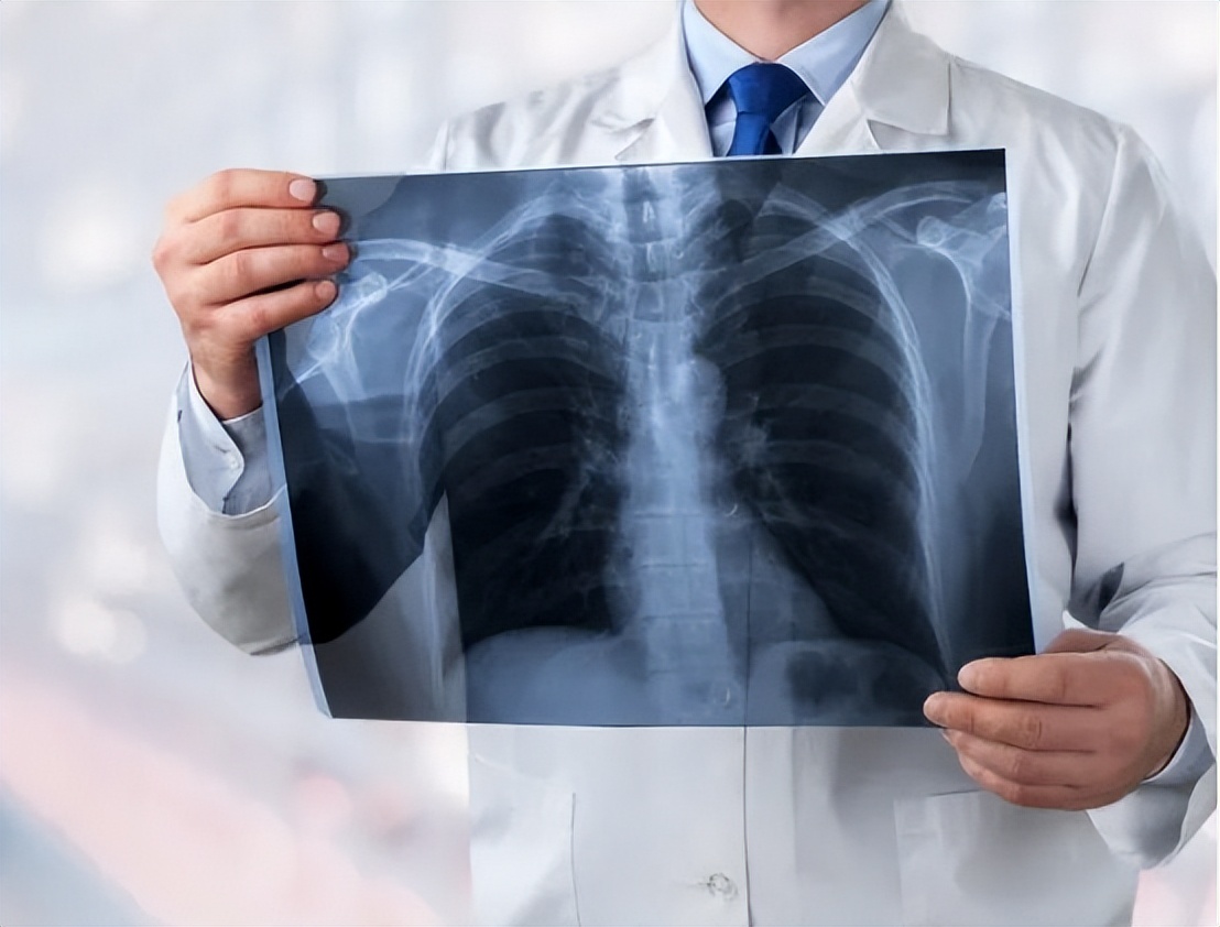 上呼吸道感染晚上咳嗽频繁,频繁上呼吸道感染