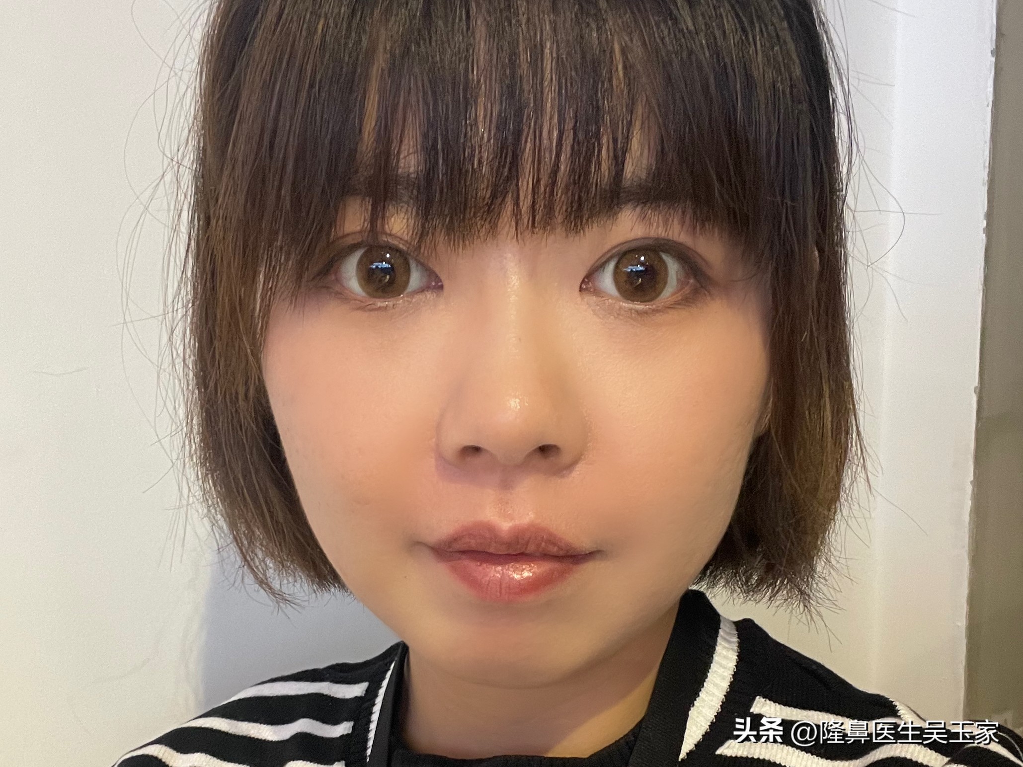 35岁去法令纹用哪个产品,去鼻纹最好的方法是什么