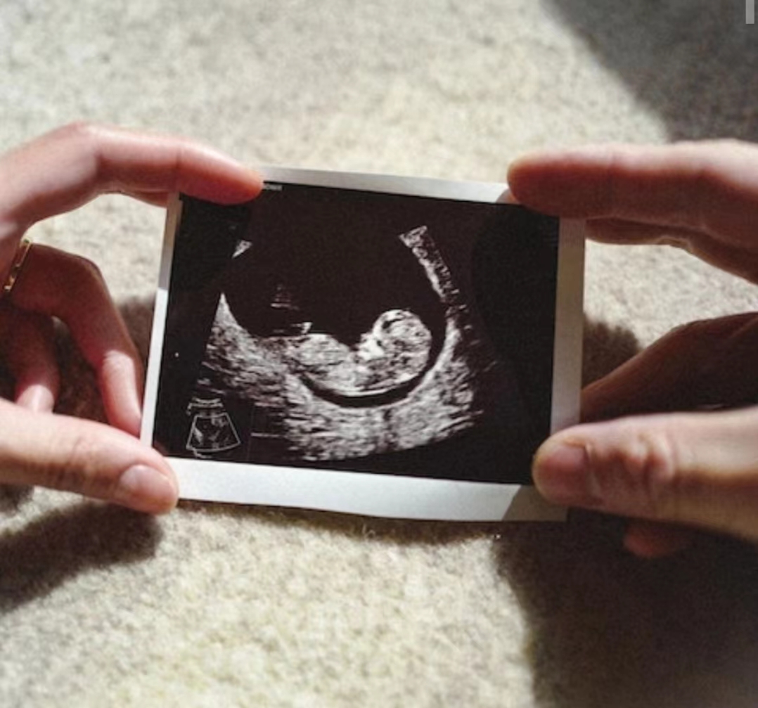 性别保密！TVB小花怀孕第4个月已明显见肚，已知男女但仍未要公开