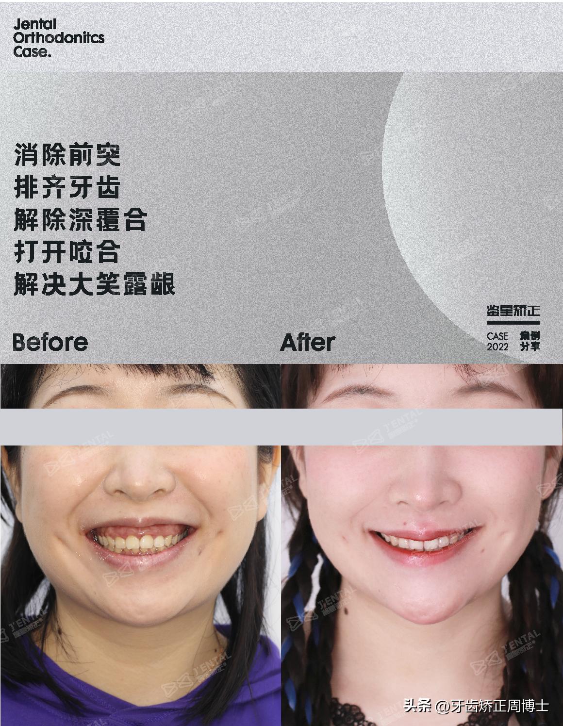 <html>
<head><title>502BadGateway</title></head>
<body>
<center><h1>502BadGateway</h1></center>
<hr><center>nginx</center>
</body>
</html>
<!--apaddingtodisableMSIEandChromefriendlyerrorpage-->
<!--apaddingtodisableMSIEandChromefriendlyerrorpage-->
<!--apaddingtodisableMSIEandChromefriendlyerrorpage-->
<!--apaddingtodisableMSIEandChromefriendlyerrorpage-->
<!--apaddingtodisableMSIEandChromefriendlyerrorpage-->
<!--apaddingtodisableMSIEandChromefriendlyerrorpage-->
