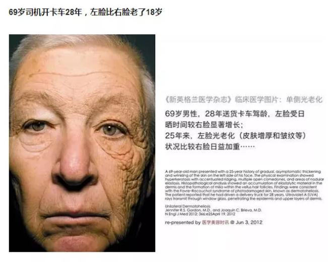 防衰老的防晒剂 (澳洲伊肤姿防晒)