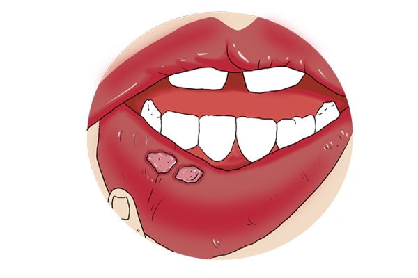 体内火气旺怎么处理,体内火气太旺怎么调理