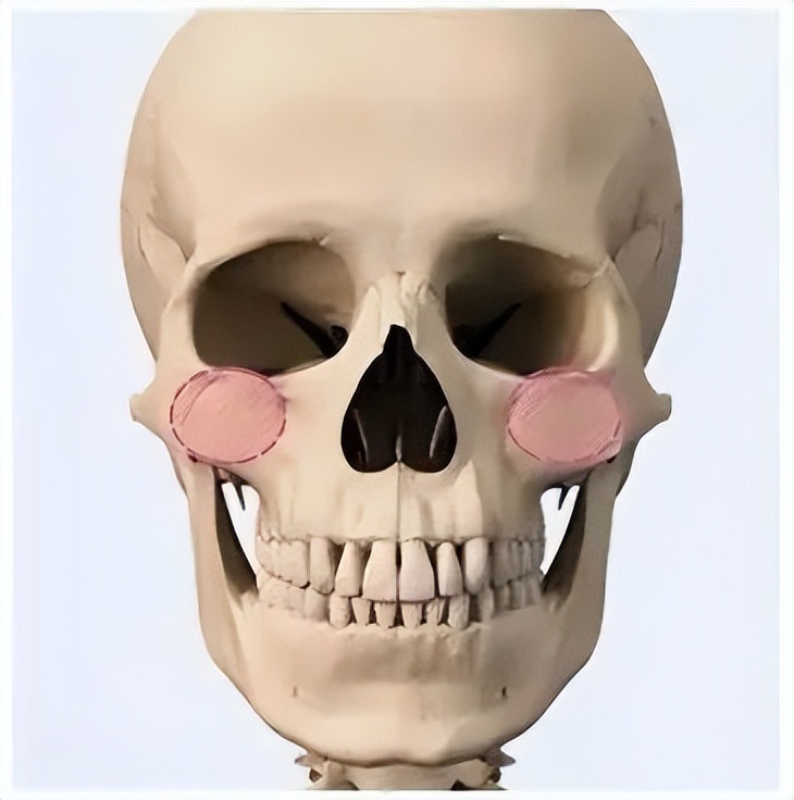 颧骨突出但不外扩面相,颧骨突出外扩男生怎么改善