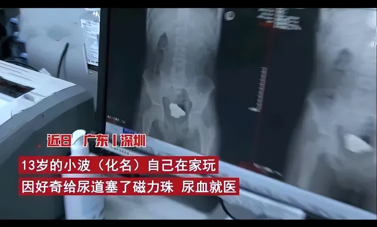 7岁女孩死亡体内却有异物,少女体内被埋神秘异物