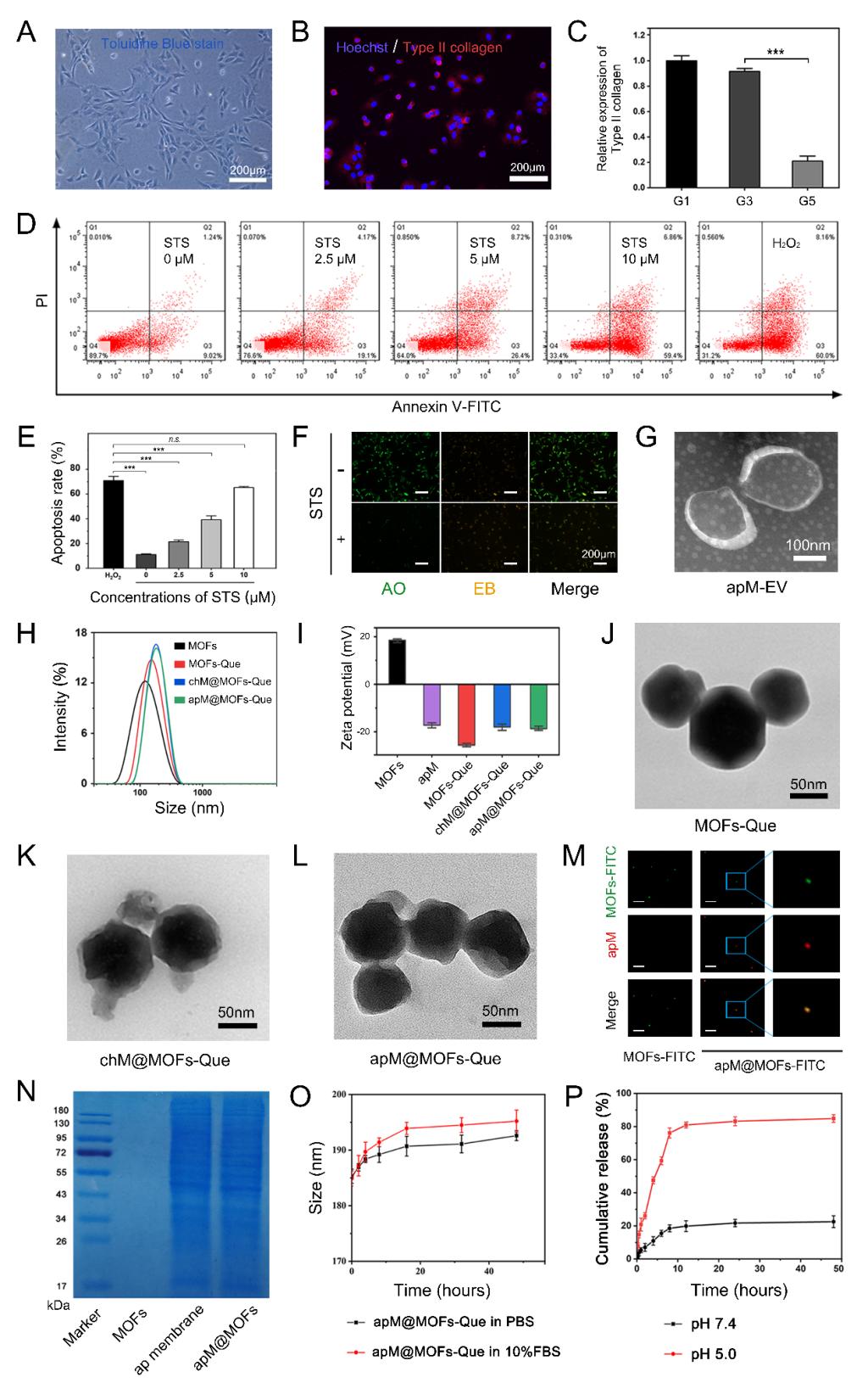 骨关节炎诊治要点及研究进展,骨性关节炎最新研究成果