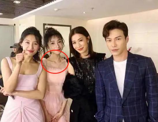 脖子青筋暴起、胸部瘦成排骨，这8位女明星的审美太畸形了