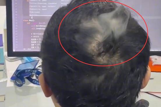 人体自燃起火之谜,人体自燃事件大揭秘