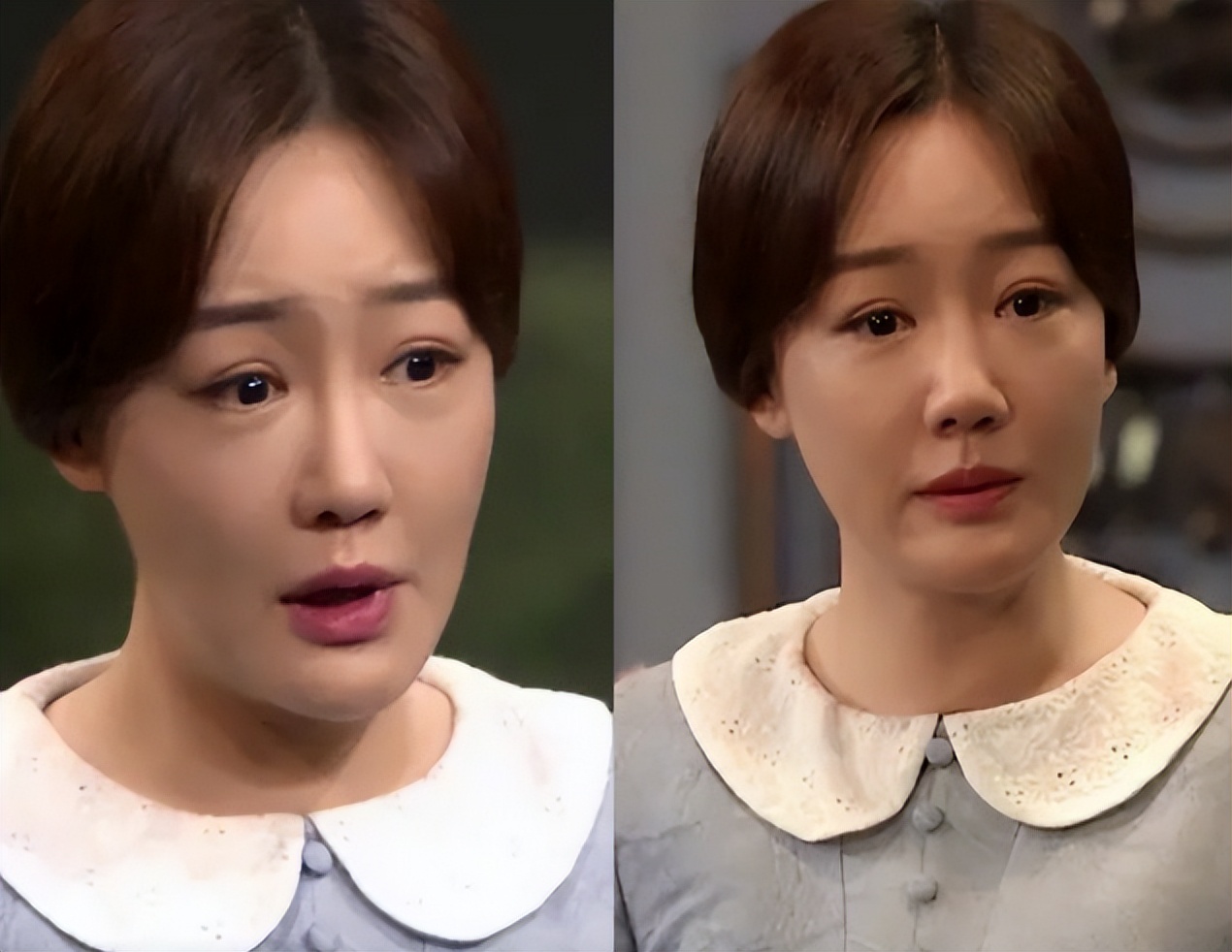 最近脸僵硬的女星,脸部变僵硬的女明星