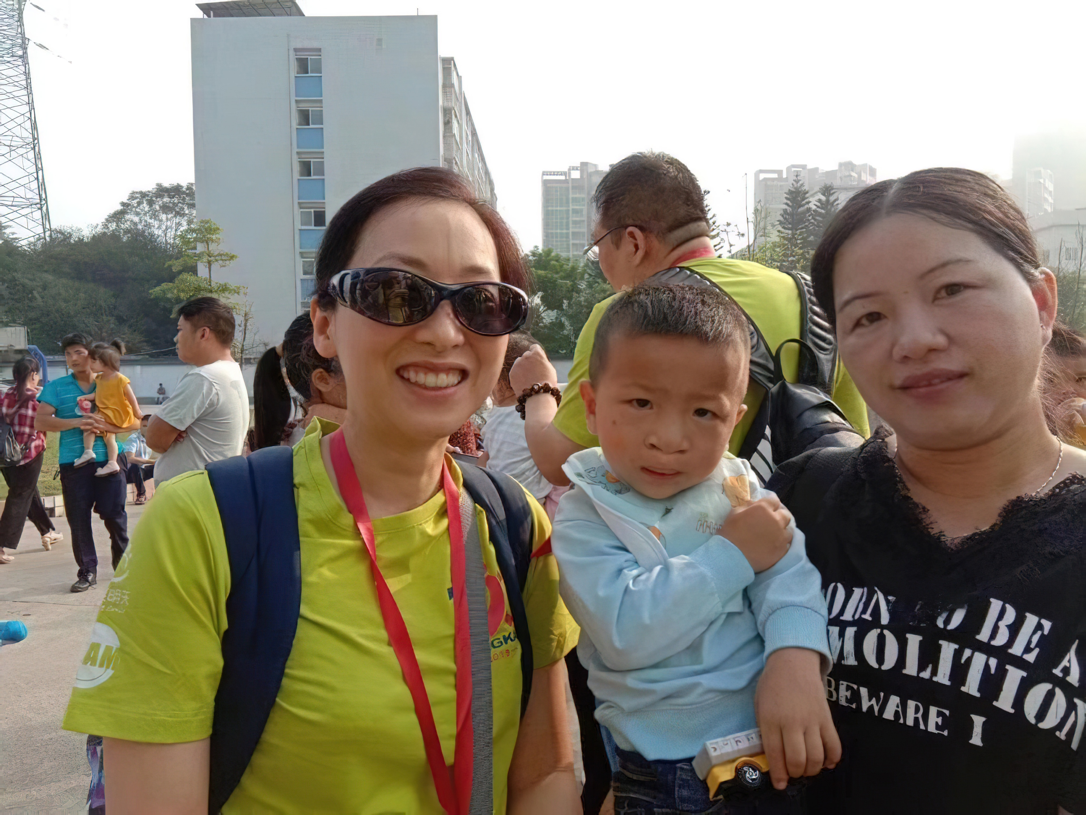 产检出胎儿唇腭裂生下来健康,42岁怀孕胎儿唇腭裂