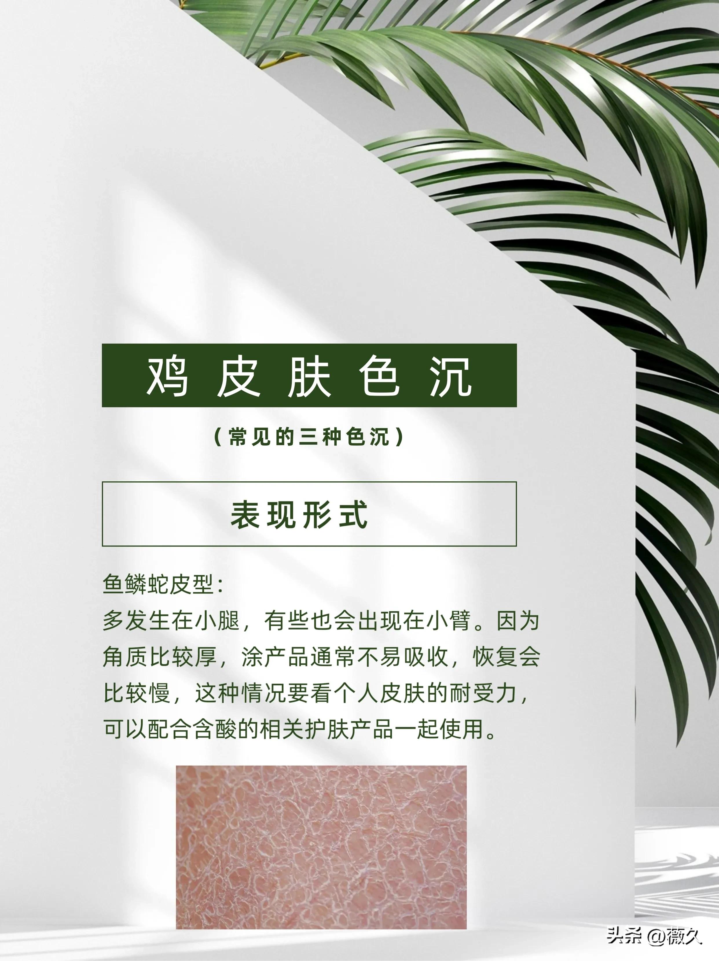 鸡皮肤必读!诱发因素+改善方法合集!