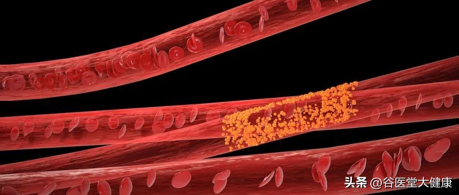 正糖名家：突然看不清东西，问题大吗？糖友要赶紧“补救”啦！