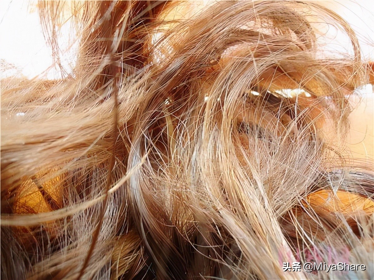 养发护发解决各种头皮问题,头屑多脱发怎么去除小妙招