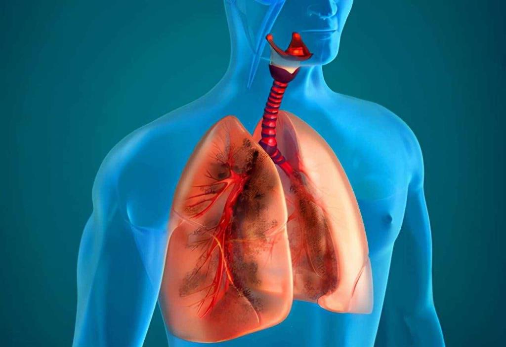 清风散热散治疗小儿风热性感冒？中医仅靠这一方子靠谱吗？