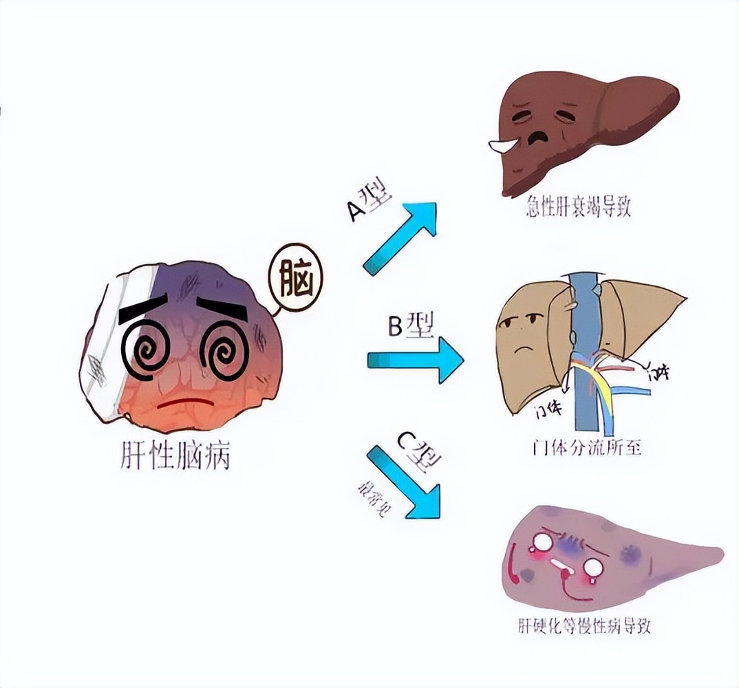 22岁月经紊乱需警惕,女性出现月经紊乱