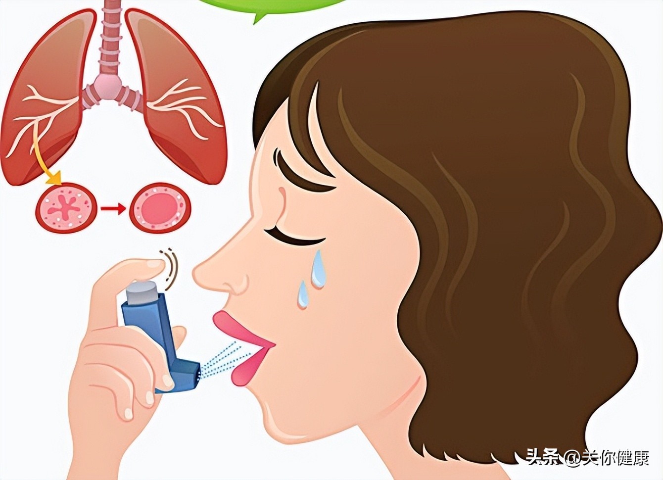 天热感觉胸闷是怎么回事,哮喘发作后一段时间的胸闷