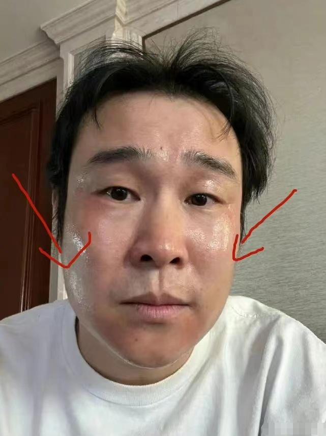 明星艺人确诊阳性,被确诊为阳性的明星