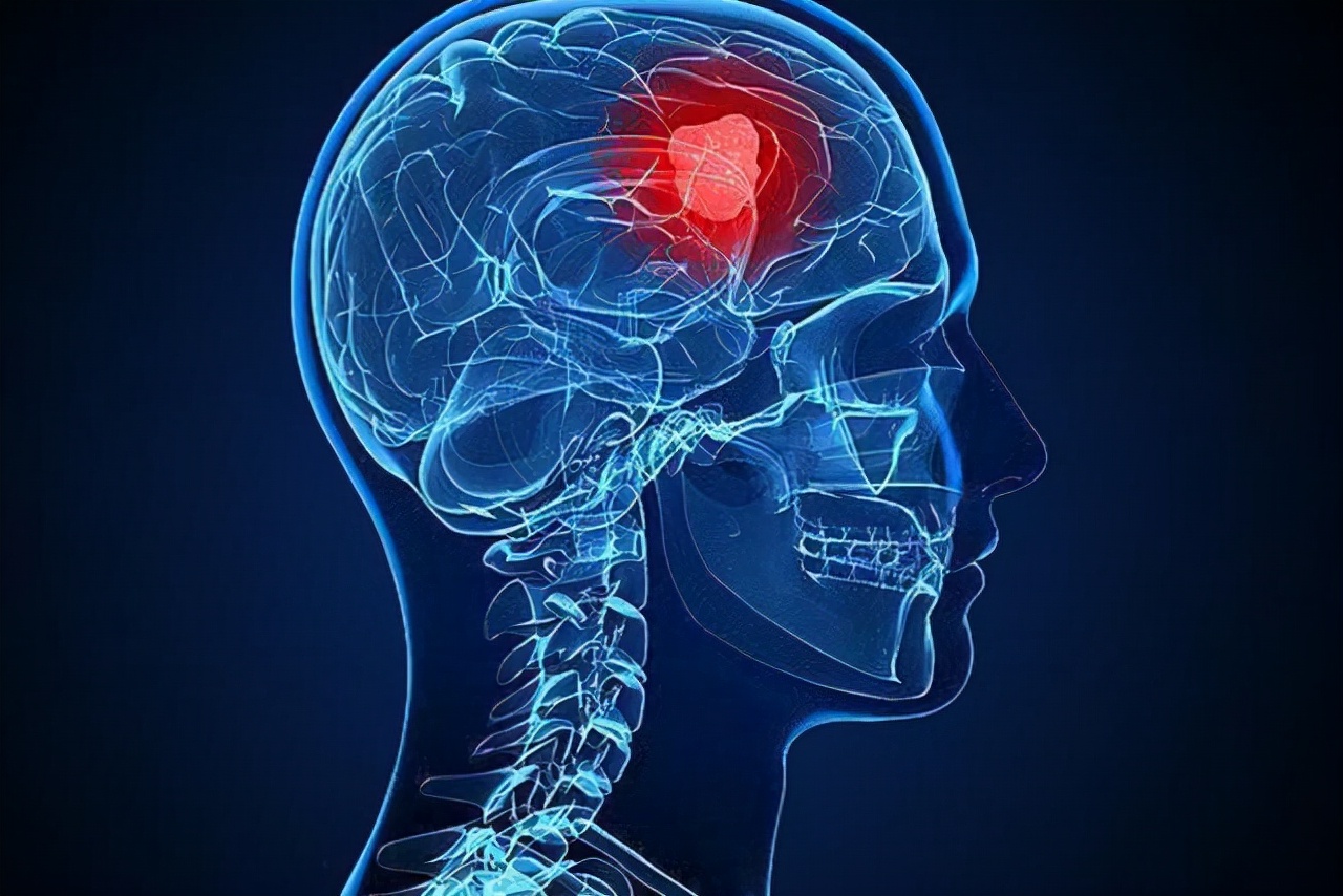 左眼皮或右眼皮跳有什么预兆,左眼皮上眼皮跳是好运还是厄运