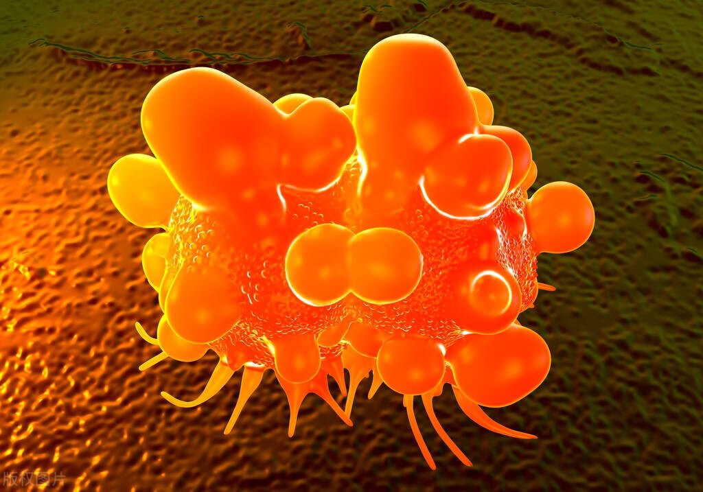 亲兄弟得了癌症给多少钱,得了癌症花钱多吗