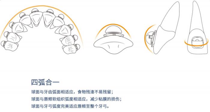 球托牙套,牙套很容易掉怎么办