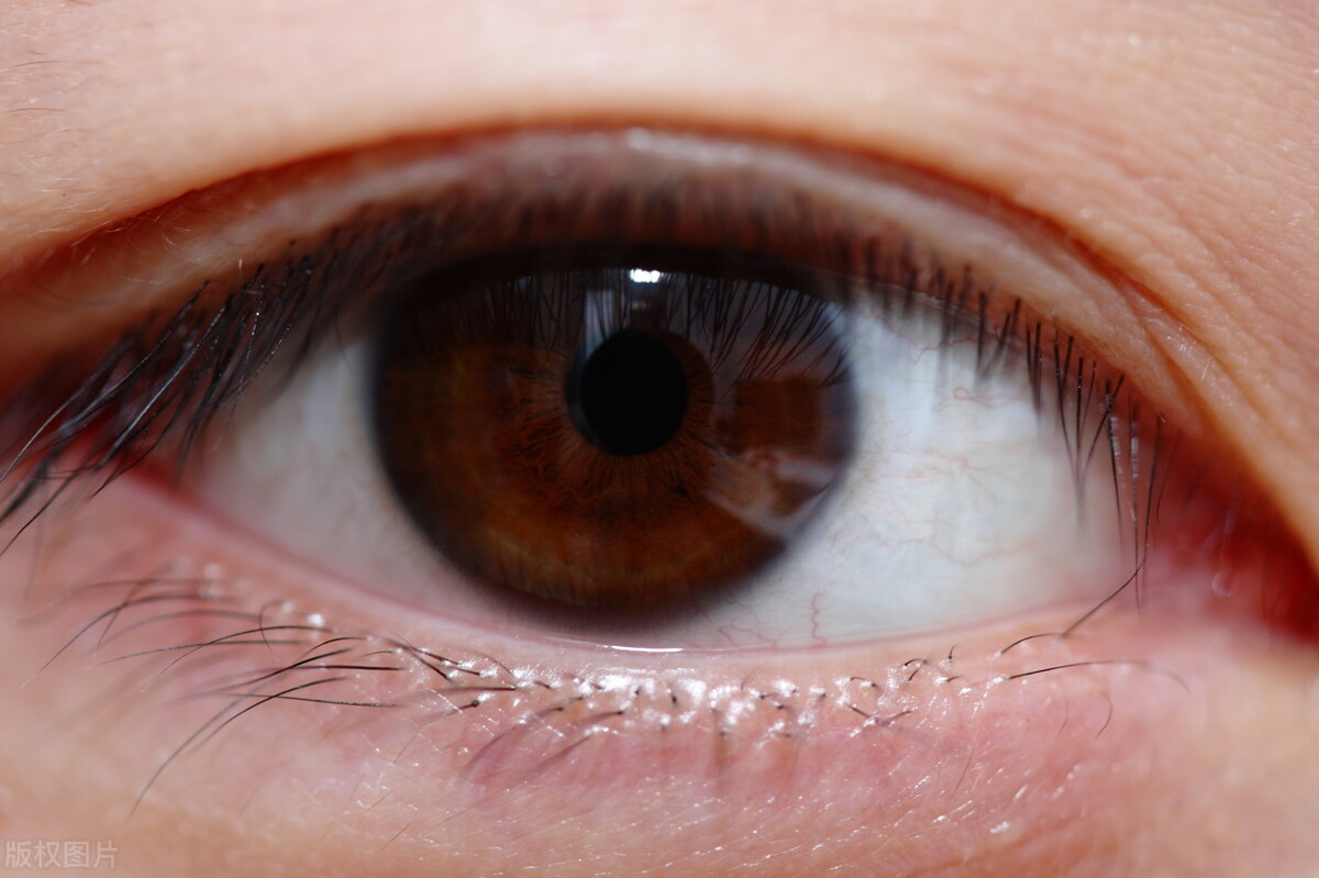 治疗视神经萎缩新方法,视神经萎缩的发病原因