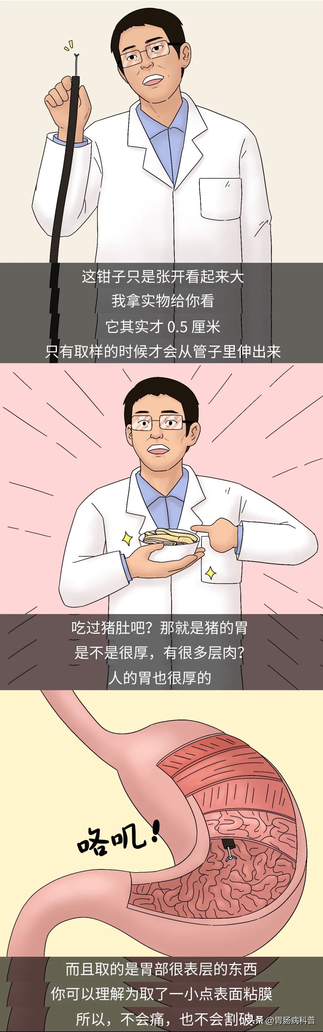 胃镜怎么做的全过程示意图,胃镜检查视频第一视角了解