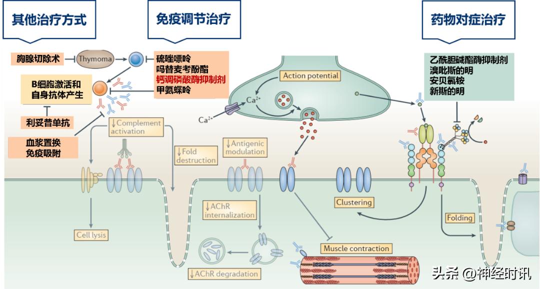 眼睑下垂型重症肌无力是什么,重症肌无力导致的眼睑下垂怎么办