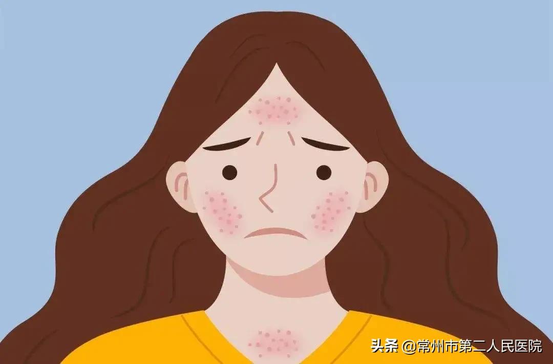 儿童手脚发热发痒是怎么回事,酒后手脚发红发痒是怎么回事