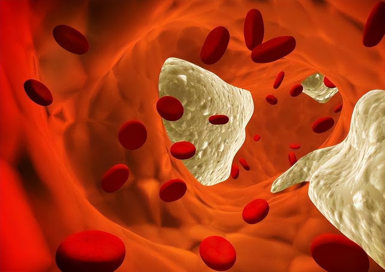 软化血管活血化瘀的中成药有哪些,心脑血管活血化瘀通络的中成药