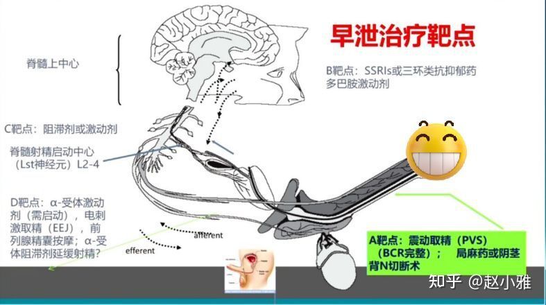 为了延时，阴茎背神经阻断术值不值得做？救命稻草还是治疗陷阱？