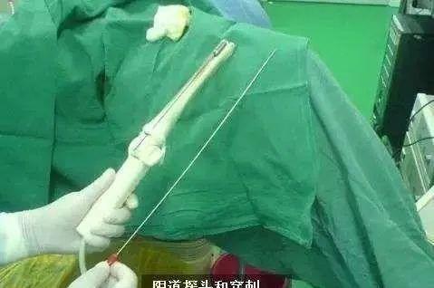 19岁女大学生离世捐器官救5人,20岁女大学生捐卵