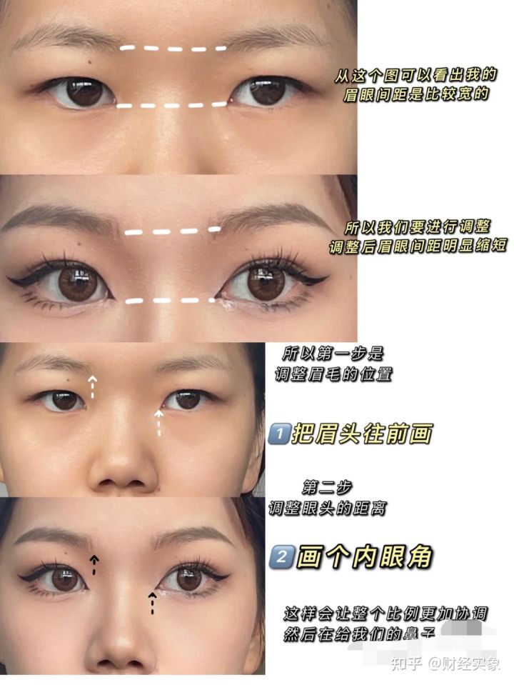 两眼间距改善最佳方法,两眼间距宽的人怎么治疗