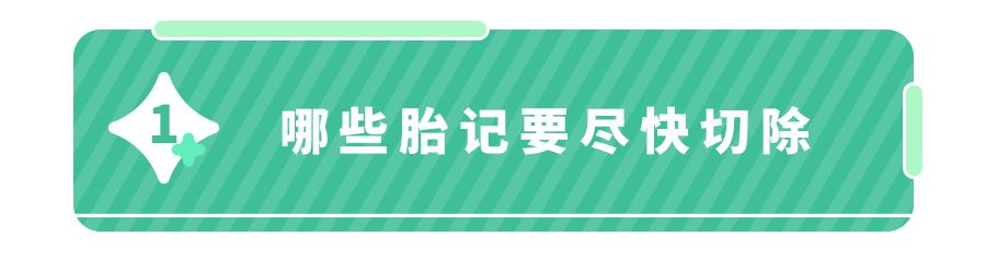 宝宝手上长胎记，一查竟是血管瘤！医生：这5种胎记要早处理