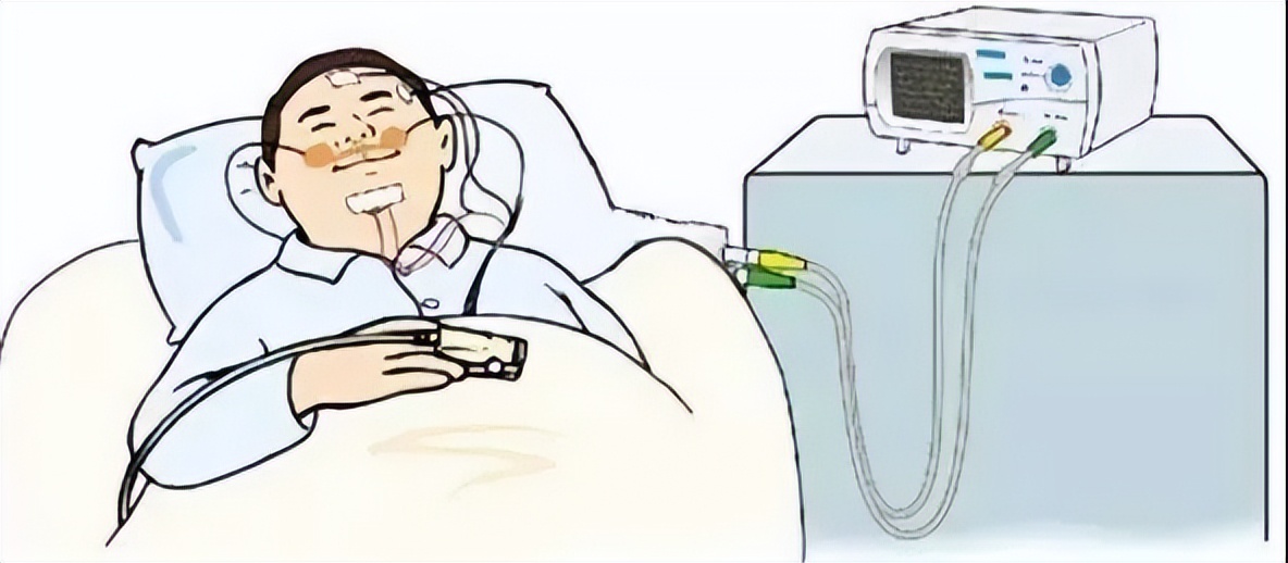 治疗打鼾需要去医院睡一觉吗,打鼾是一种病吗视频