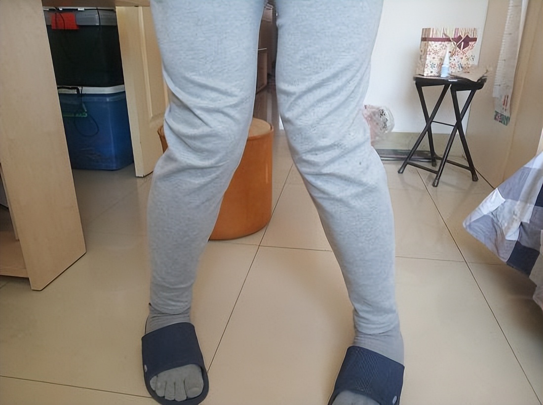 膝关节伸直时咯噔响是怎么回事,膝关节弹响的原因及治疗方法