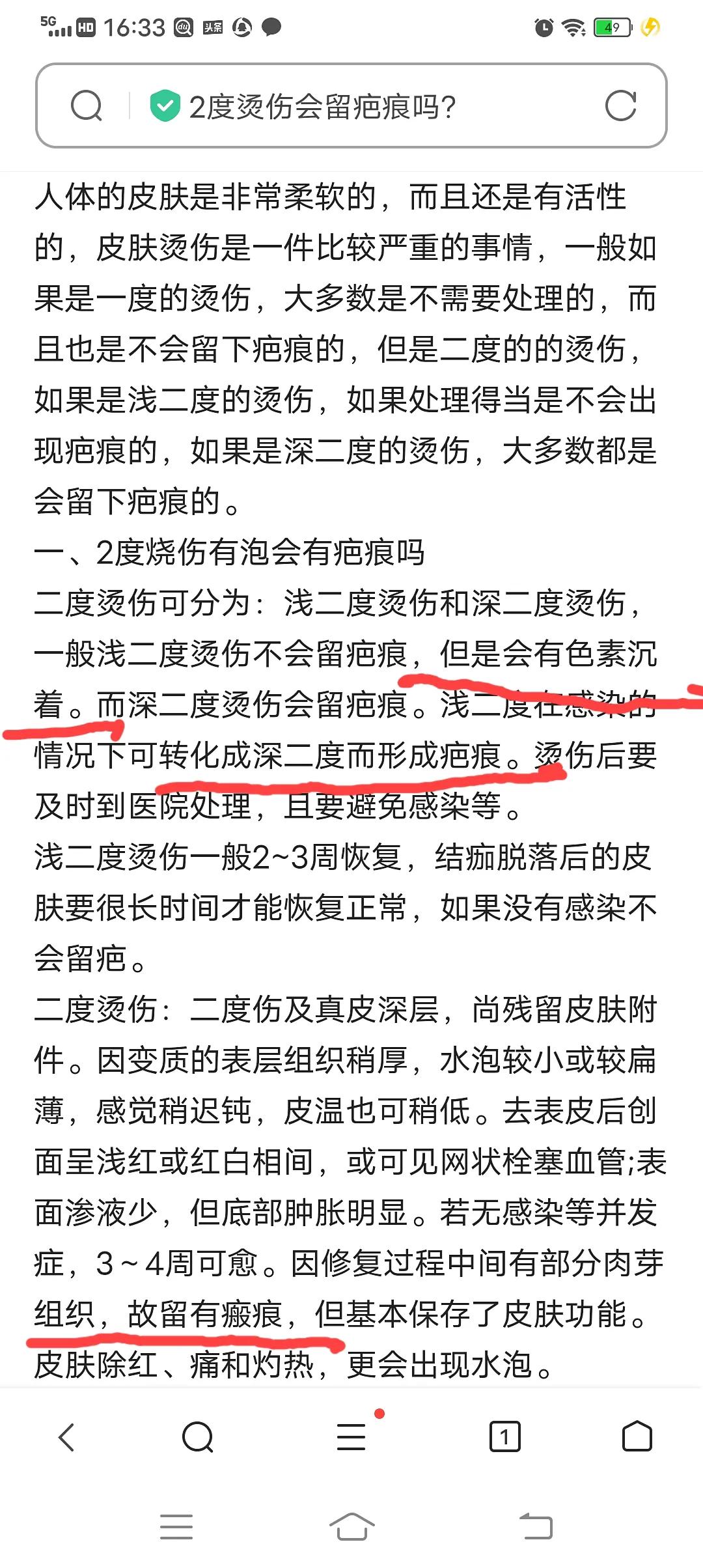比基尼脱毛全脱的危害,比基尼脱毛会不会烫伤