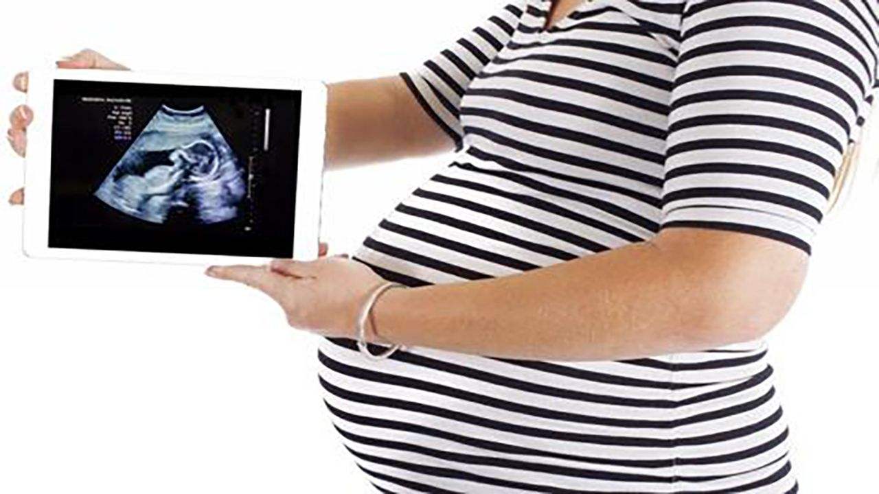 顺产vs剖宫产到底哪个好,剖宫产和顺产哪个好得快