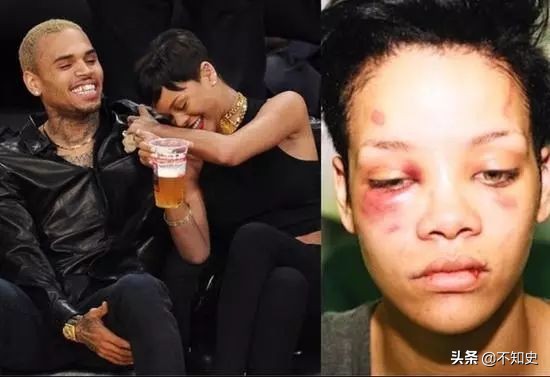 一双美腿价值百万美金，身价高达110亿，其中91亿靠卖内衣？