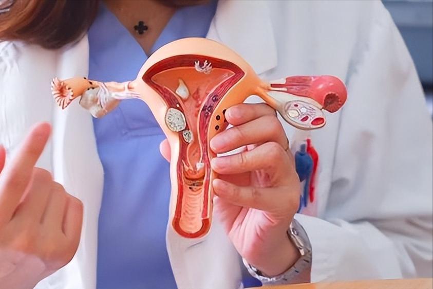 女性“上环”的全过程，会不会伤害女性健康？男女都要好好看看！