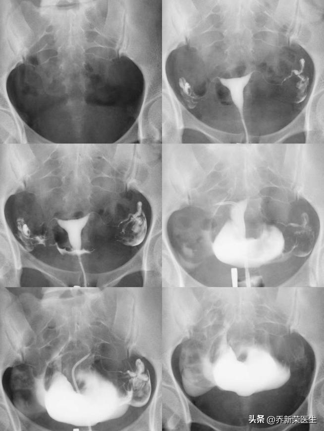 有一种职业叫幼师，有一种痛叫呵护他人的孩子，自己却迟迟怀不上