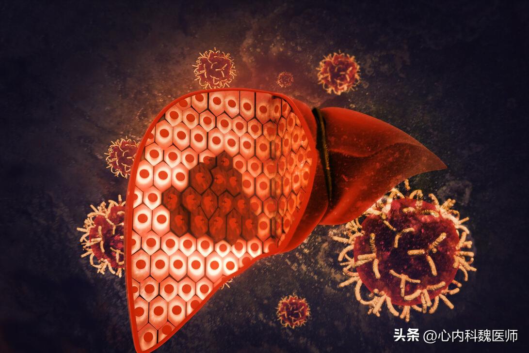 钇90微球疗法肝癌效果,钇90树脂微球治疗肝癌手术费用