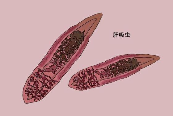 故事：湖北55岁男子病从口入，孕出成千上万虫卵，肚子竟成虫窝