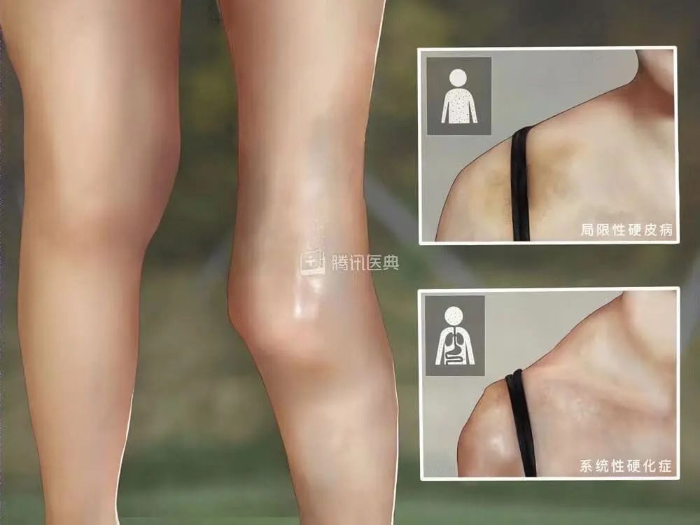 11岁男童额头上长满小疙瘩,10岁男孩子额头长斑