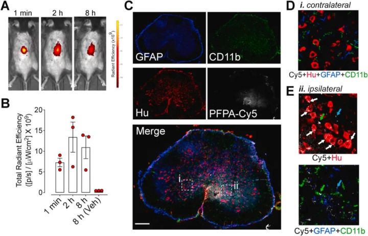 脑科学阿尔茨海默,有关阿尔茨海默症的科普文章