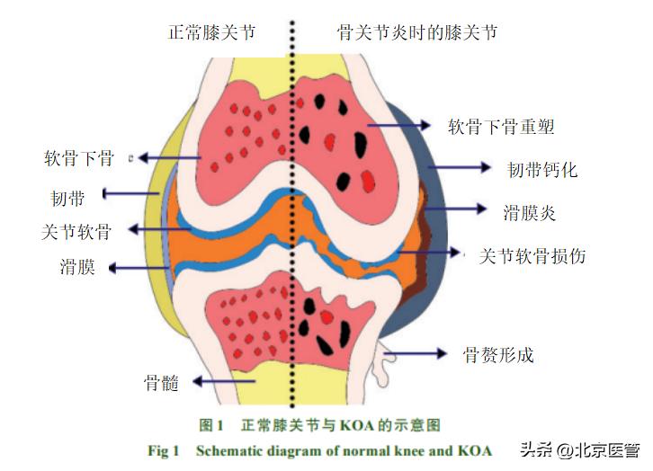 医生给的关于治疗膝盖的处方药,医生推荐膝盖药