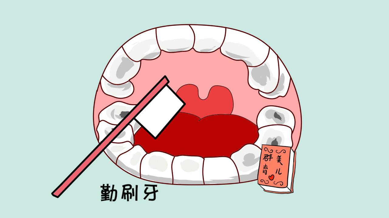 牙缝有牙结石怎么去除,牙缝间的牙结石怎么清除