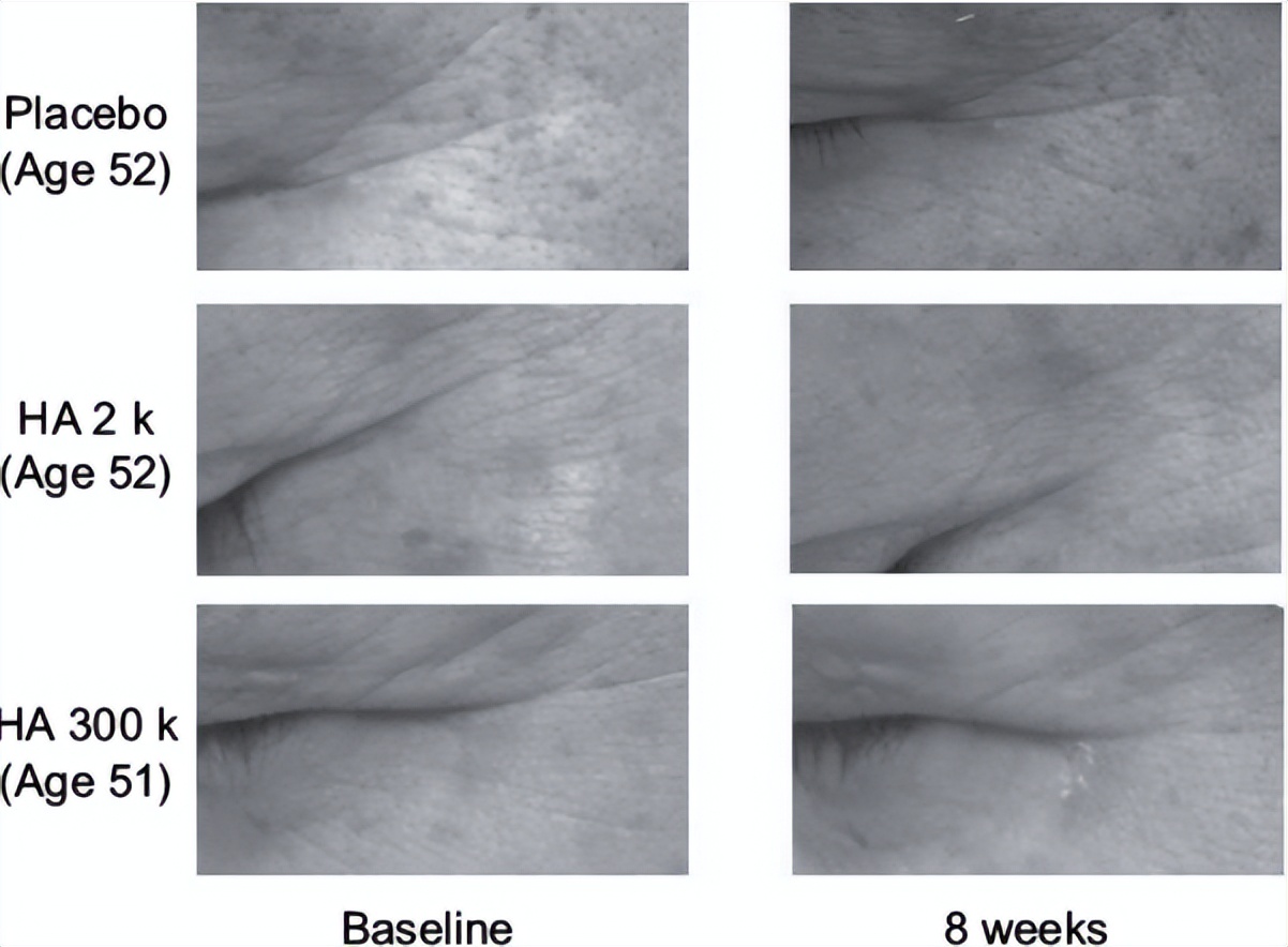 美人心计有讲护肤知识的吗,美人新计